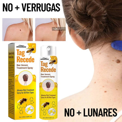 ¡OPORTUNIDAD! TAG RECEDE - Eliminador de Verrugas y Manchas (ORIGINAL)