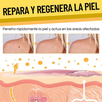 ¡OPORTUNIDAD! TAG RECEDE - Eliminador de Verrugas y Manchas (ORIGINAL)