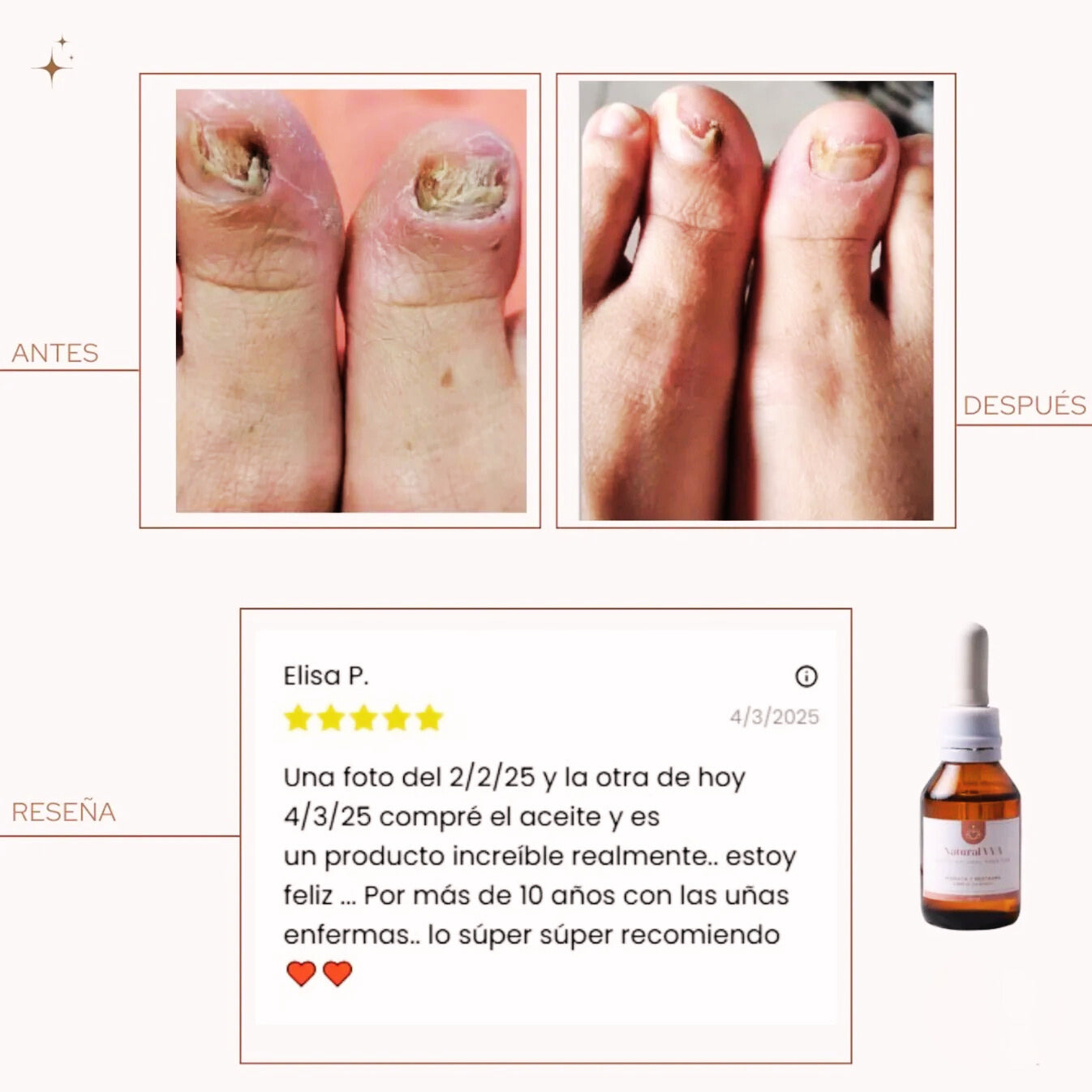 Nuevo Aceite Antihongos para PIES - Resultados Rápidos!