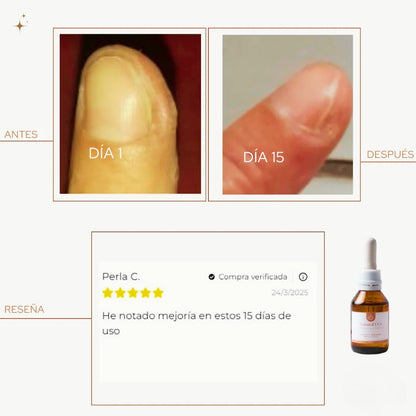 Nuevo Aceite Antihongos para PIES - Resultados Rápidos!